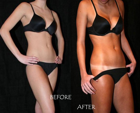 bikini wax before and after images